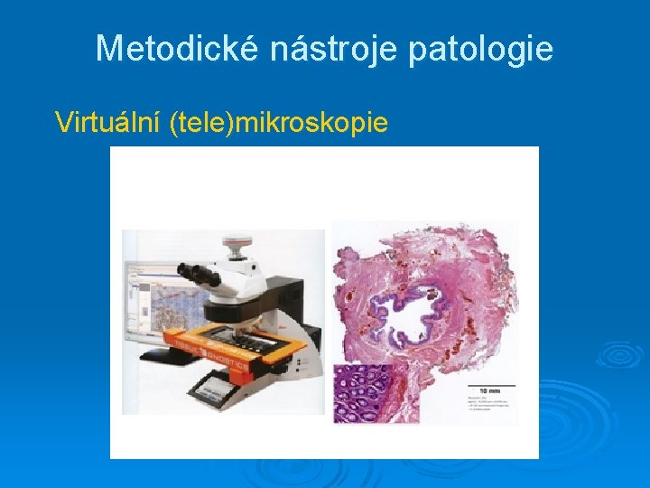 Metodické nástroje patologie Virtuální (tele)mikroskopie 