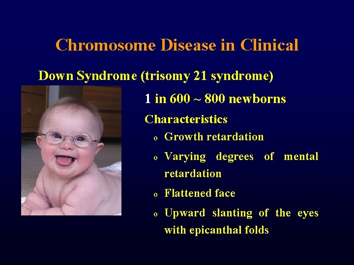 Chromosome Disease in Clinical Down Syndrome (trisomy 21 syndrome) 1 in 600 ~ 800