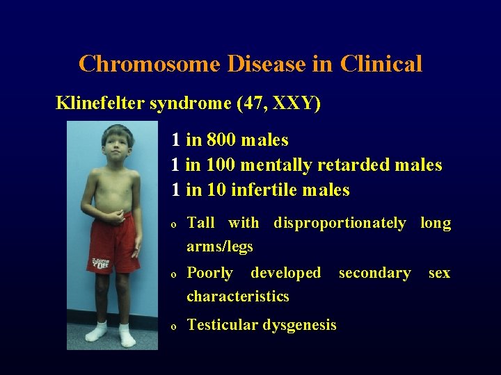 Chromosome Disease in Clinical Klinefelter syndrome (47, XXY) 1 in 800 males 1 in