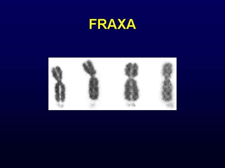 FRAXA 