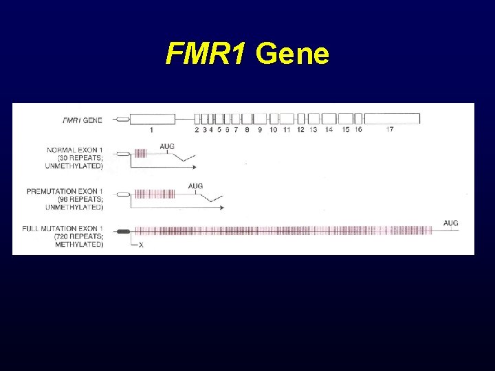 FMR 1 Gene 