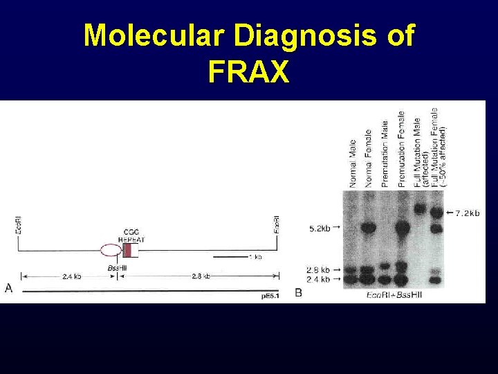 Molecular Diagnosis of FRAX 