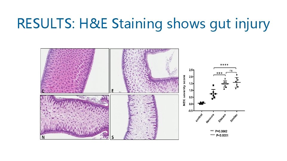 RESULTS: H&E Staining shows gut injury 