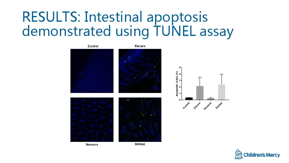 RESULTS: Intestinal apoptosis demonstrated using TUNEL assay 