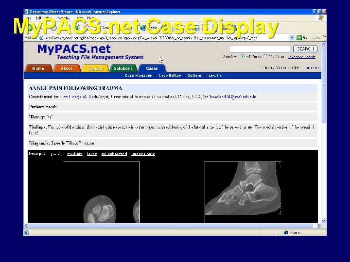 My. PACS. net Case Display 