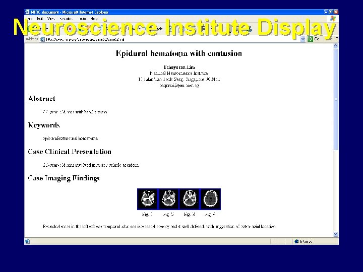 Neuroscience Institute Display 