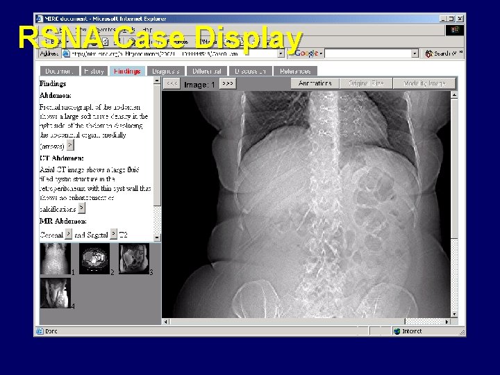 RSNA Case Display 