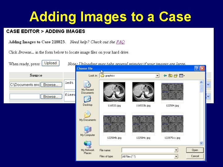 Adding Images to a Case 