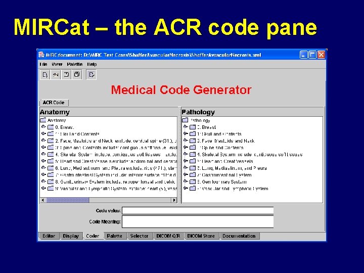 MIRCat – the ACR code pane 