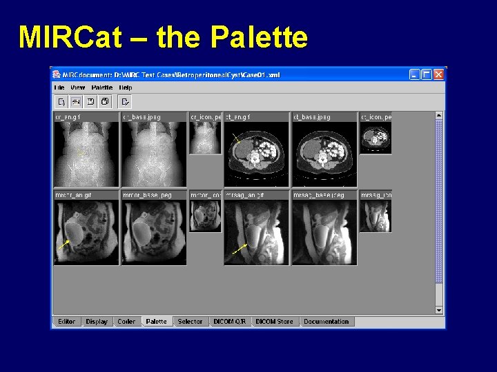 MIRCat – the Palette 