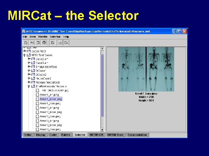 MIRCat – the Selector 