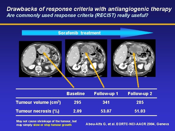 Drawbacks of response criteria with antiangiogenic therapy Are commonly used response criteria (RECIST) really