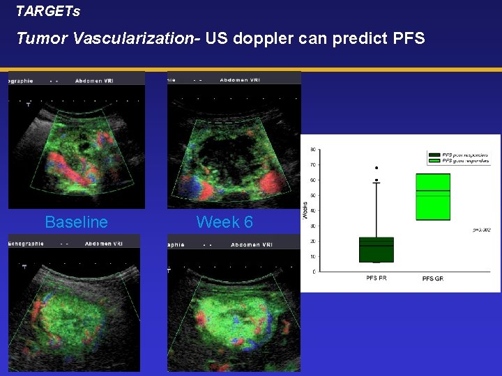 TARGETs Tumor Vascularization- US doppler can predict PFS Baseline Week 6 