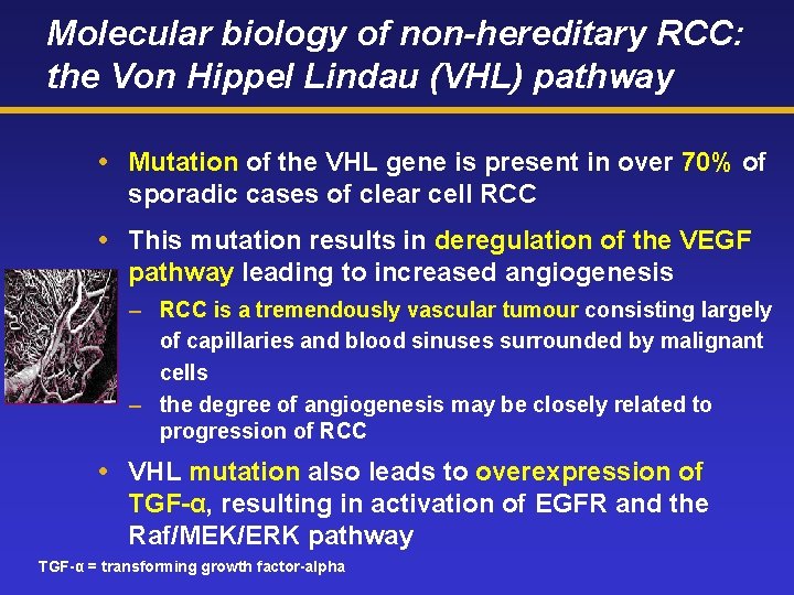 Molecular biology of non-hereditary RCC: the Von Hippel Lindau (VHL) pathway Mutation of the
