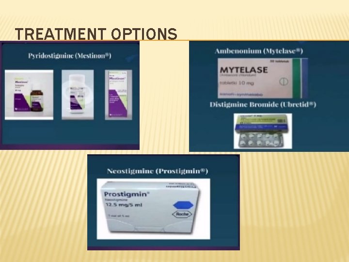 TREATMENT OPTIONS 