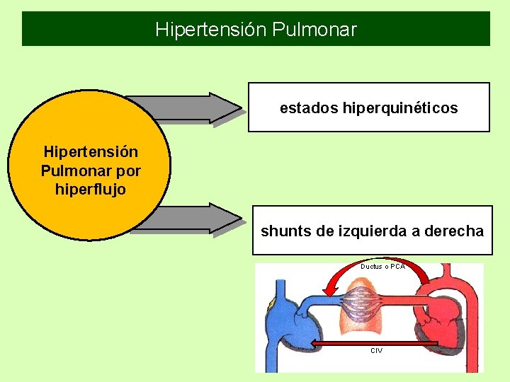 Hipertensión Pulmonar estados hiperquinéticos Hipertensión Pulmonar por hiperflujo shunts de izquierda a derecha Ductus Hipertensión Pulmonar estados hiperquinéticos Hipertensión Pulmonar por hiperflujo shunts de izquierda a derecha Ductus