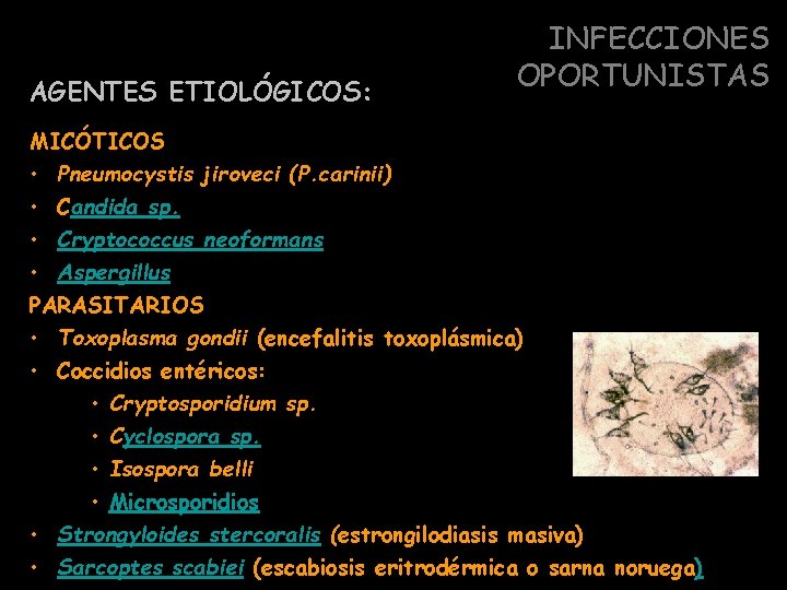 AGENTES ETIOLÓGICOS: INFECCIONES OPORTUNISTAS MICÓTICOS • Pneumocystis jiroveci (P. carinii) • Candida sp. •