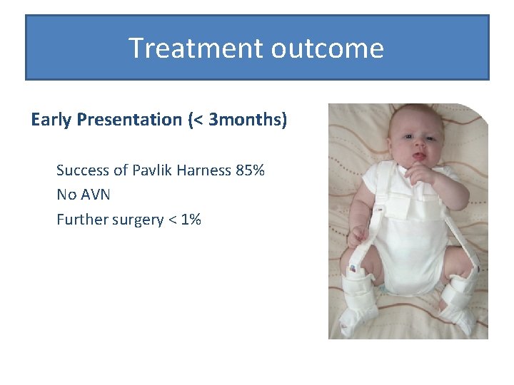 Treatment outcome Early Presentation (< 3 months) Success of Pavlik Harness 85% No AVN