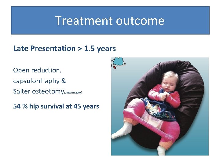 Treatment outcome Late Presentation > 1. 5 years Open reduction, capsulorrhaphy & Salter osteotomy(JBJSAm