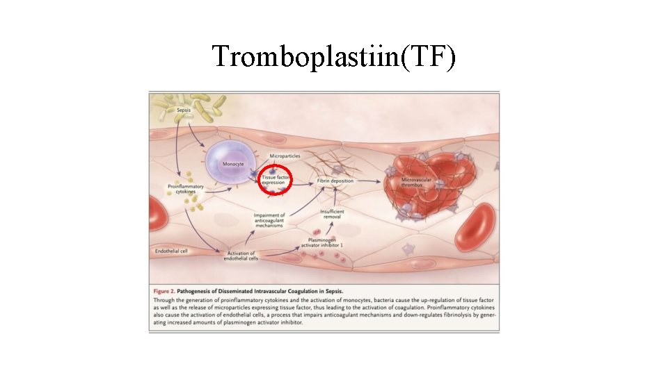 Tromboplastiin(TF) 