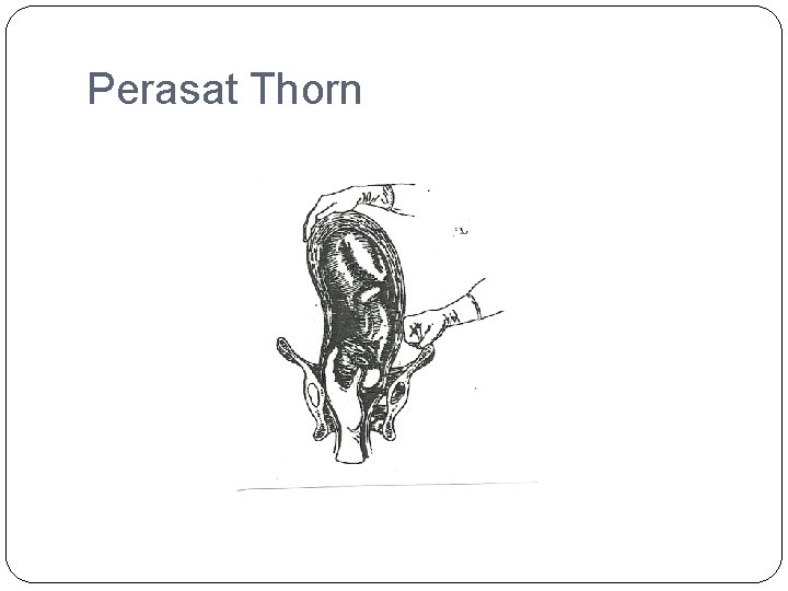 Perasat Thorn 