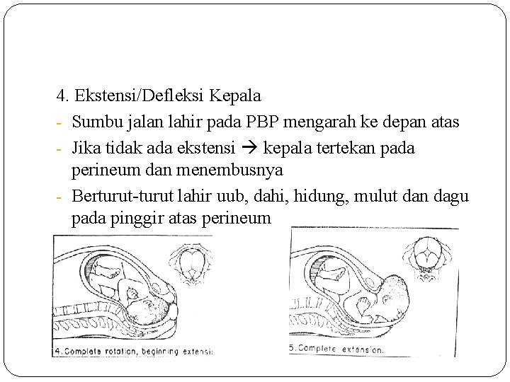 4. Ekstensi/Defleksi Kepala - Sumbu jalan lahir pada PBP mengarah ke depan atas -