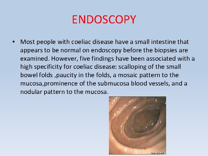 ENDOSCOPY • Most people with coeliac disease have a small intestine that appears to