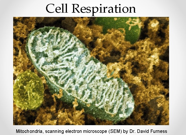 Cell Respiration Mitochondria, scanning electron microscope (SEM) by Dr. David Furness 