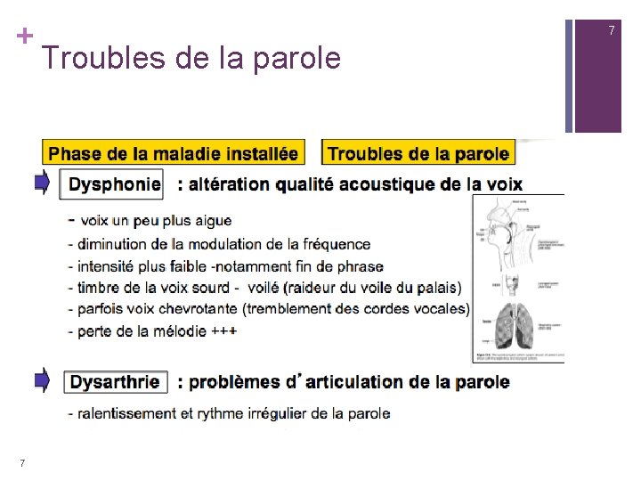 + 7 7 Troubles de la parole 