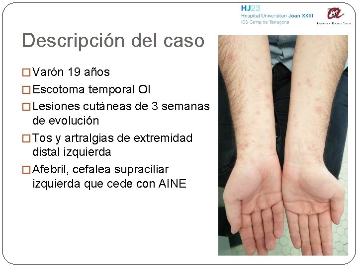 Descripción del caso � Varón 19 años � Escotoma temporal OI � Lesiones cutáneas
