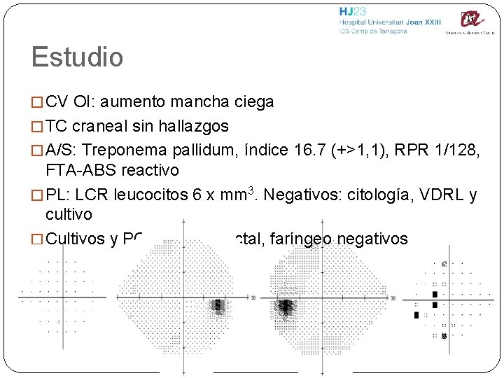 Estudio � CV OI: aumento mancha ciega � TC craneal sin hallazgos � A/S: