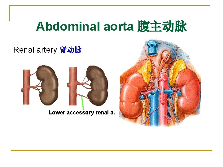 Abdominal aorta 腹主动脉 Renal artery 肾动脉 Lower accessory renal a. 