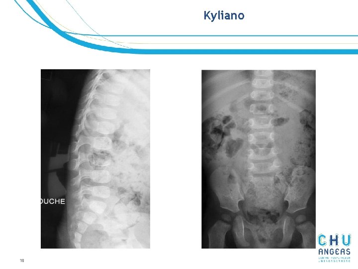 Kyliano 19 Kyliano 19
