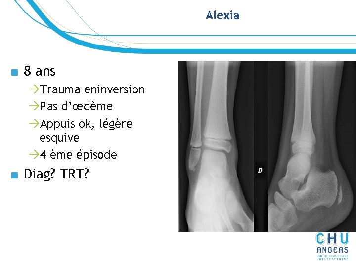 Alexia ■ 8 ans àTrauma eninversion àPas d’œdème àAppuis ok, légère esquive à 4 Alexia ■ 8 ans àTrauma eninversion àPas d’œdème àAppuis ok, légère esquive à 4