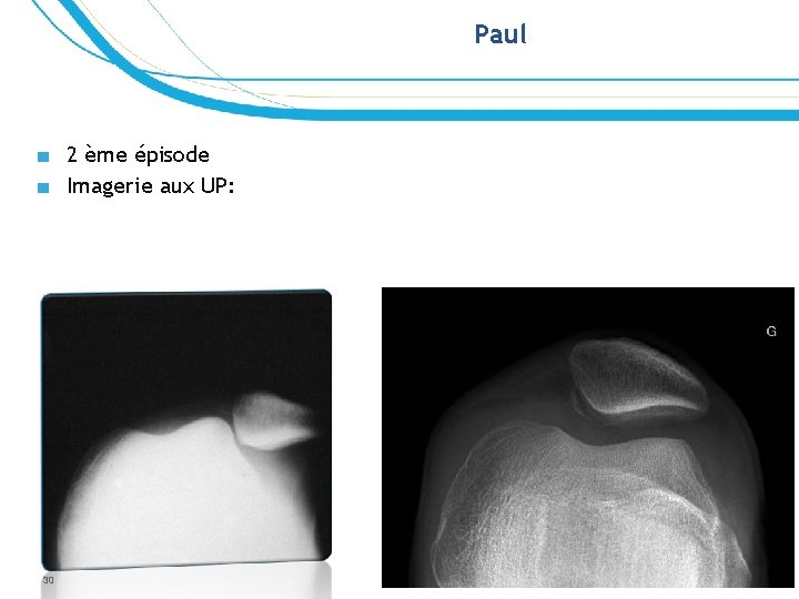 Paul ■ 2 ème épisode ■ Imagerie aux UP: 30 Paul ■ 2 ème épisode ■ Imagerie aux UP: 30