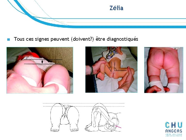 Zélia ■ Tous ces signes peuvent (doivent? ) être diagnostiqués Zélia ■ Tous ces signes peuvent (doivent? ) être diagnostiqués