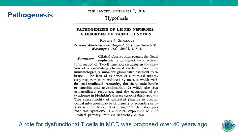 Pathogenesis A role for dysfunctional T cells in MCD was proposed over 40 years Pathogenesis A role for dysfunctional T cells in MCD was proposed over 40 years