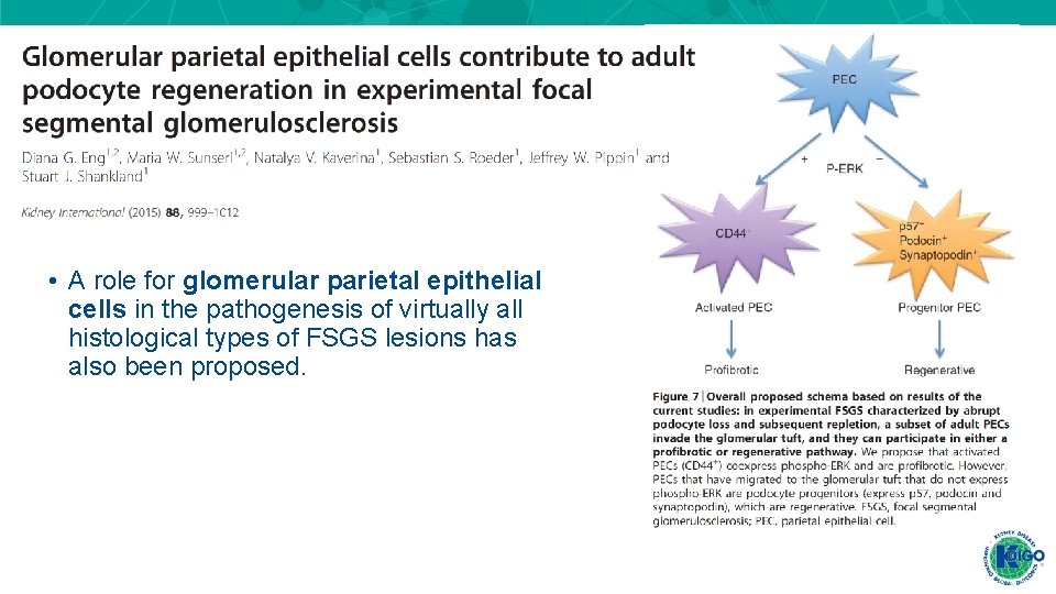 • A role for glomerular parietal epithelial cells in the pathogenesis of virtually • A role for glomerular parietal epithelial cells in the pathogenesis of virtually