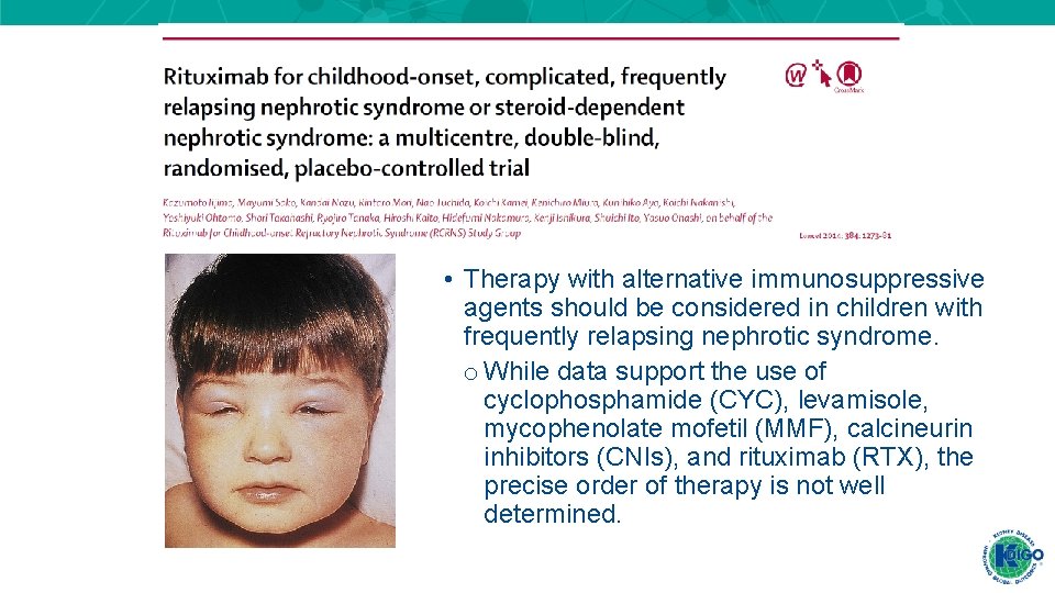 • Therapy with alternative immunosuppressive agents should be considered in children with frequently • Therapy with alternative immunosuppressive agents should be considered in children with frequently