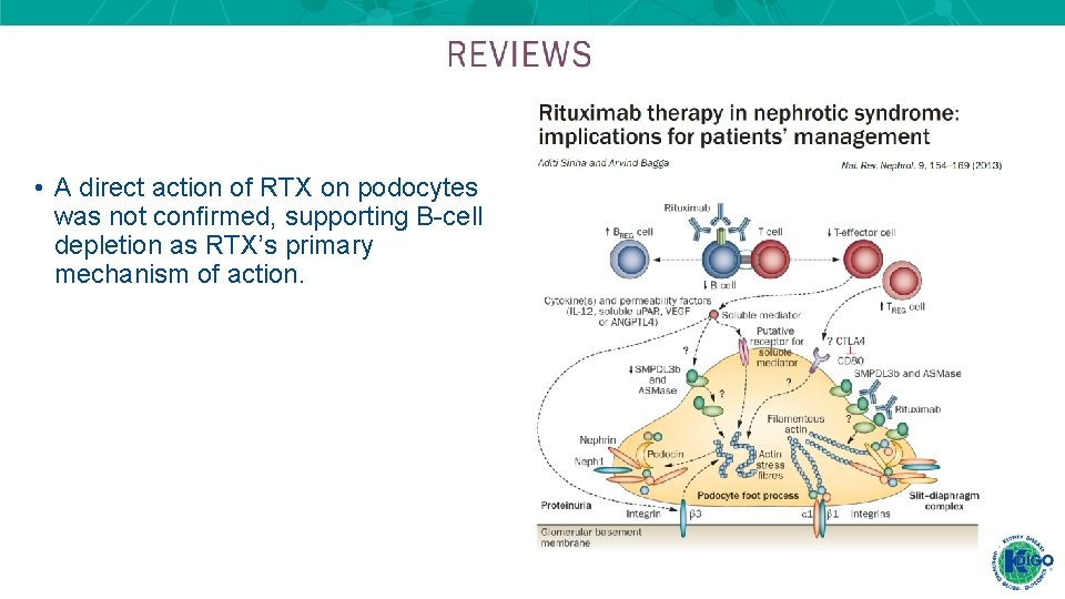 • A direct action of RTX on podocytes was not confirmed, supporting B-cell • A direct action of RTX on podocytes was not confirmed, supporting B-cell