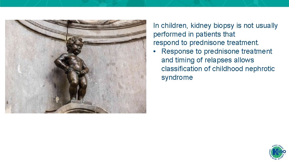 In children, kidney biopsy is not usually performed in patients that respond to prednisone In children, kidney biopsy is not usually performed in patients that respond to prednisone