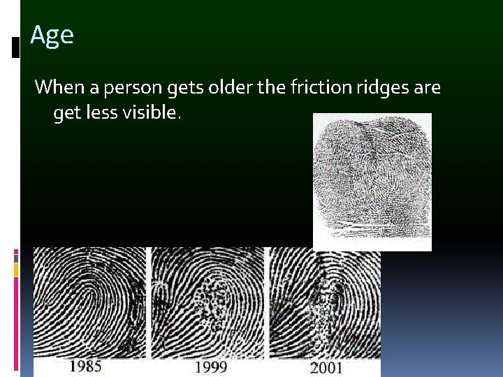 Age When a person gets older the friction ridges are get less visible. 