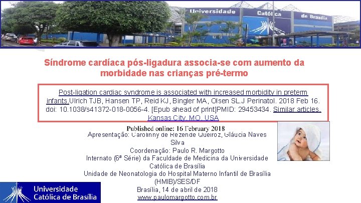 Síndrome cardíaca pós-ligadura associa-se com aumento da morbidade nas crianças pré-termo Post-ligation cardiac syndrome