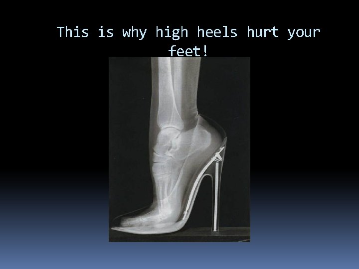 This is why high heels hurt your feet! 