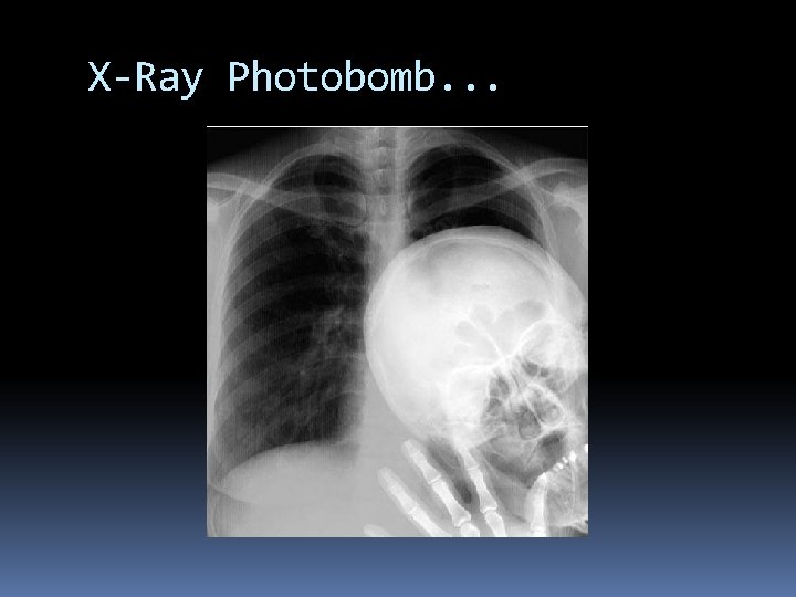 X-Ray Photobomb. . . 