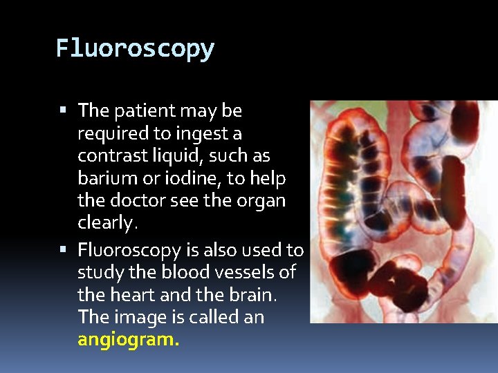 Fluoroscopy The patient may be required to ingest a contrast liquid, such as barium