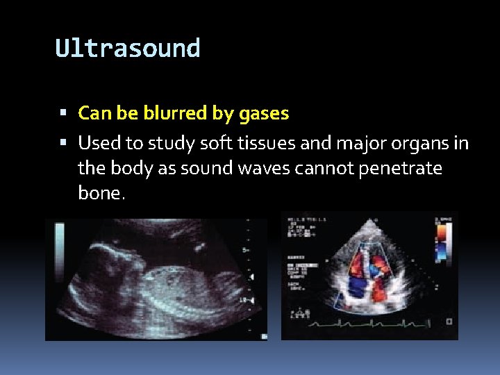 Ultrasound Can be blurred by gases Used to study soft tissues and major organs