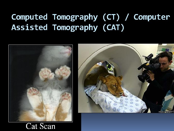 Computed Tomography (CT) / Computer Assisted Tomography (CAT) 