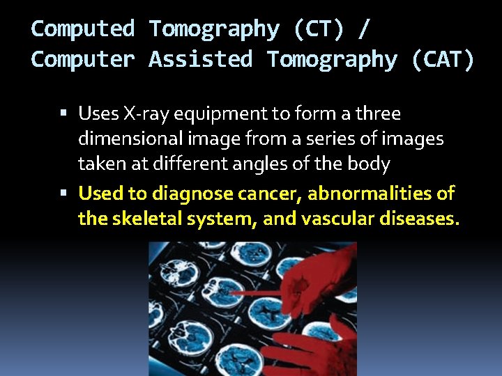 Computed Tomography (CT) / Computer Assisted Tomography (CAT) Uses X-ray equipment to form a
