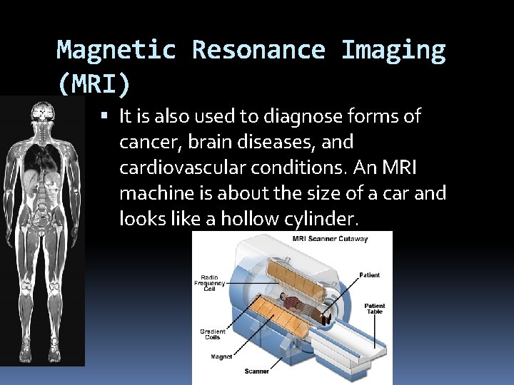 Magnetic Resonance Imaging (MRI) It is also used to diagnose forms of cancer, brain